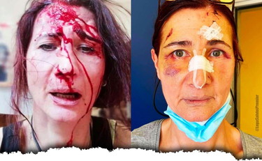 Gli chiede di mettere la mascherina e l'africano la riduce così. Salvini posta le foto choc: bella integrazione