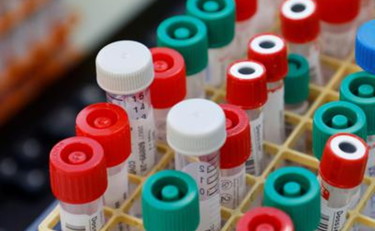 Coronavirus: test rapidi o tamponi? Circolare ministero Salute fa chiarezza