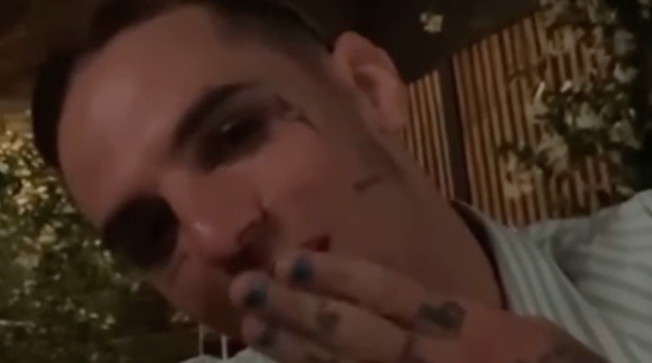 Clamoroso Achille Lauro! Gli scappa una parola di troppo e mette in crisi il matrimonio Fedez-Ferragni!