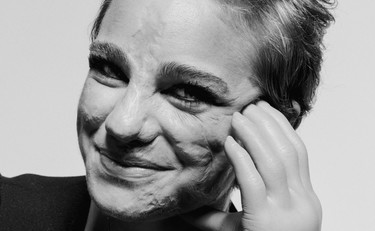 Non mi sono ancora ripresa. La romanista Bebe Vio non ce la fa più