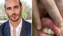 Ex ballerino di Amici aggredito: così Simone Baroni può incastrare quegli omofobi