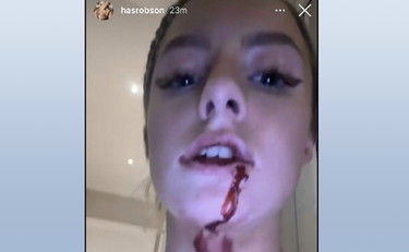 La fidanzata pubblica lividi e sangue sul volto, arrestato giocatore del Manchester