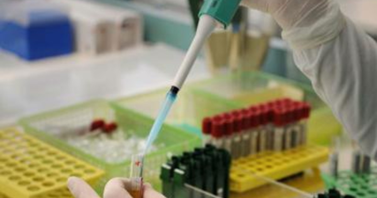 Sanità: da Europa a Usa crescono casi vaiolo scimmie, anche contagi locali Sanità: da Europa a Usa crescono casi vaiolo scimmie, anche contagi locali