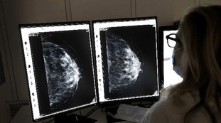 Sei mesi d'attesa per una visita, caos sanità a Roma