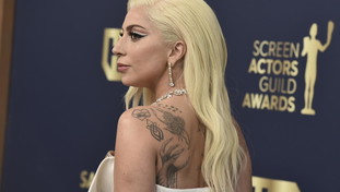 Che è successo a Lady Gaga: ridotta così dopo aver interrotto il concerto