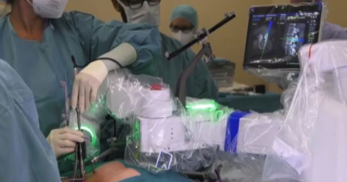 Guida Per Filo Demel In Acciaio Inossidabile | Strumenti - Foto 1