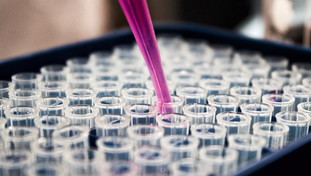 Super-variante mortale creata in laboratorio. Allarme degli scienziati: così è partito il disastro