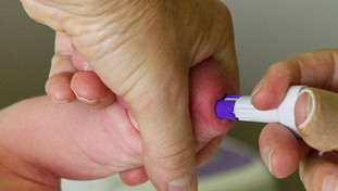 Enterovirus spaventa genitori e Oms: allerta per i neonati, sintomi e conseguenze