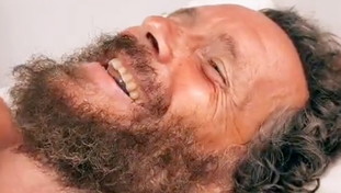 Un attimo di distrazione e poi la rovinosa caduta: Jovanotti in ospedale