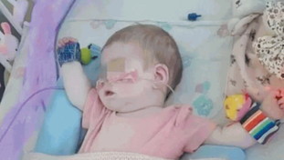 L'Italia adotta la piccola Indi. E i genitori ringraziano il governo Meloni: “Nuova speranza”