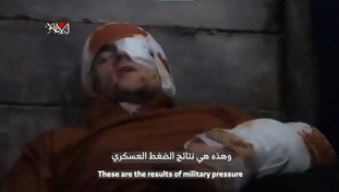 Ennesimo video dell'orrore di Hamas: a cosa viene costretto l'ostaggio ferito gravemente