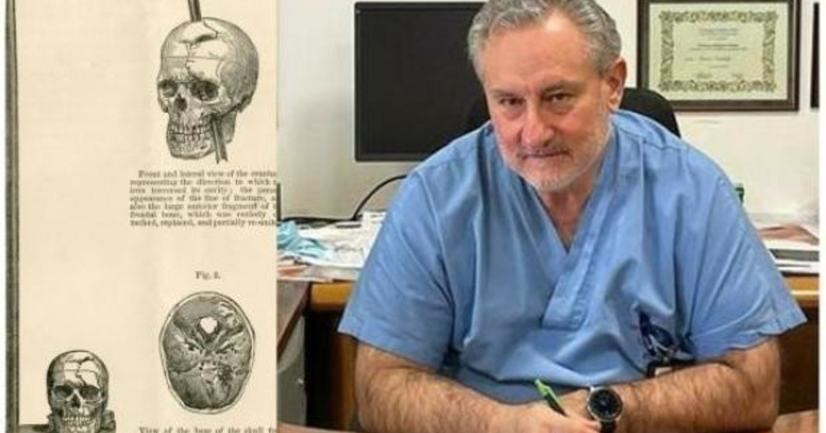 “Un miracolo chirurgico” colpito da una freccia in testa, sopravvive due giorni “Un miracolo chirurgico” colpito da una freccia in testa, sopravvive due giorni
