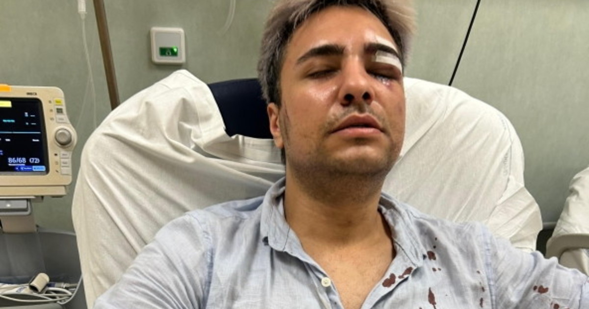 Insulti omofobi poi il pestaggio. Ragazzo di 25 anni aggredito dal branco