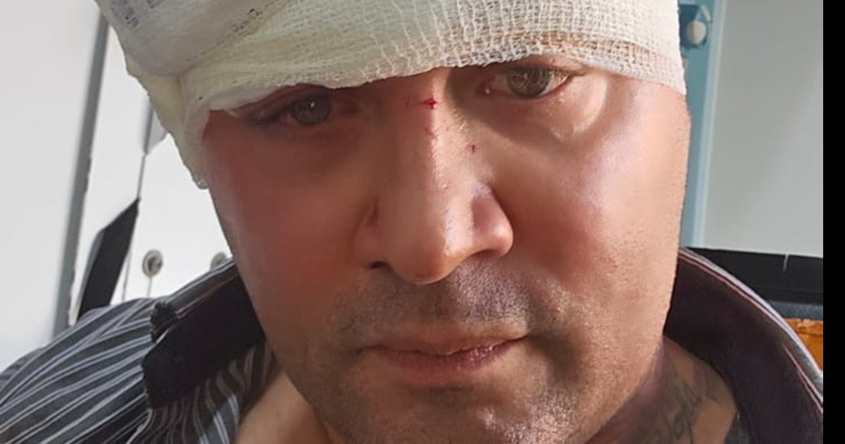 Aggredito il capogruppo della Lega Sibilla: "Non mi farò intimidire" Aggredito il capogruppo della Lega Sibilla: "Non mi farò intimidire"