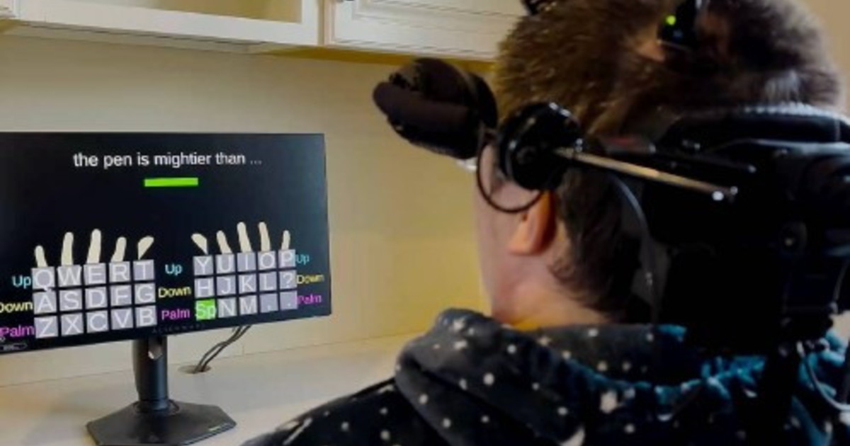Un nuovo impianto neurale restituisce la parola a chi è paralizzato Un nuovo impianto neurale restituisce la parola a chi è paralizzato