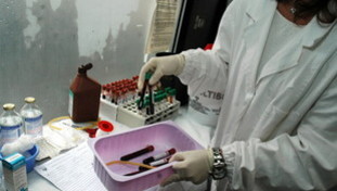 Epatite a Napoli, sono 53 i contagiati. La Regione aumenta l'offerta di vaccini