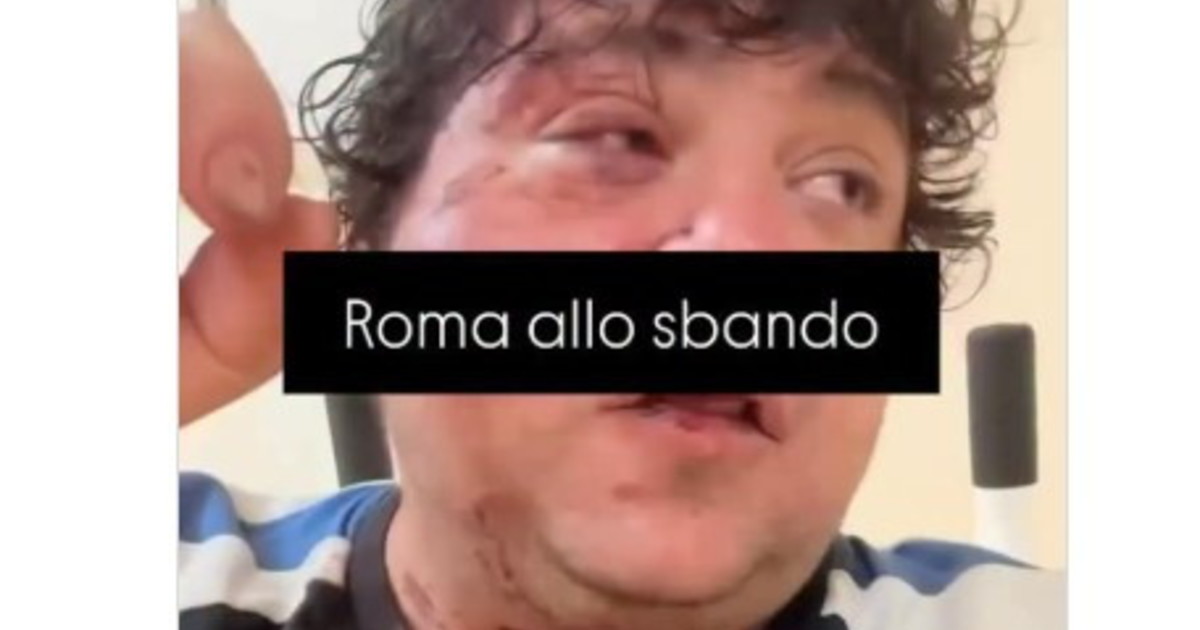 San Lorenzo, il rapper pestato dal branco e quelle sviolinat