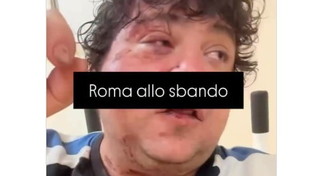 San Lorenzo, il rapper pestato dal branco e quelle sviolinate sulla (finta) integrazione