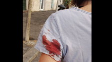 Paura a Prati, ancora spari da pistola ad aria compressa contro i passanti: Dolore fortissimo e sangue